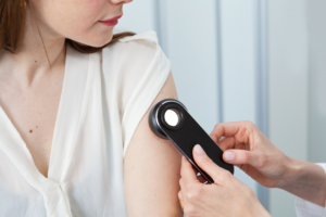 What Happens During a Skin Cancer Test? - Steele Creek Dermatology