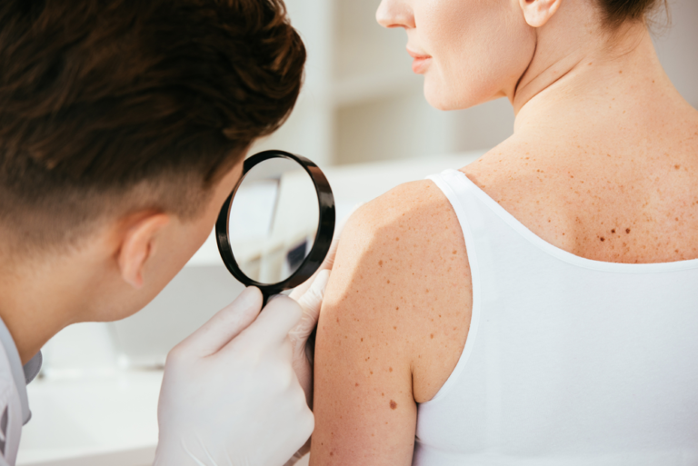 who-should-get-a-skin-cancer-test-steele-creek-dermatology